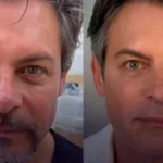 luigi-baricelli-revela-resultado-de-harmonizacao-facial-aos-54-anos-no-sbt:-antes-e-depois-chamam-atencao