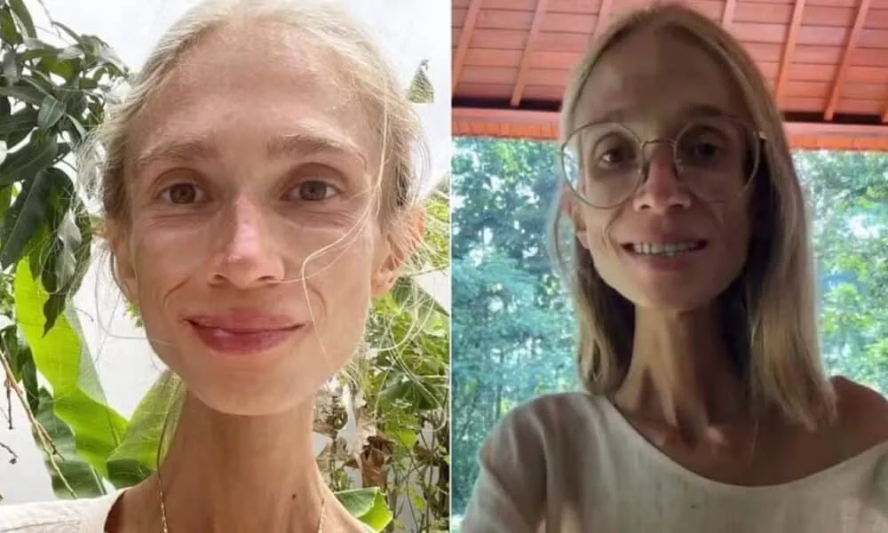 jovem-segue-dieta-so-de-frutas-cruas-e-falece-em-bali-por-falta-de-nutrientes