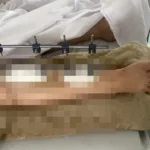 atropelamento-em-posto-de-combustiveis-deixa-vitima-internada-no-hugo-em-goiania