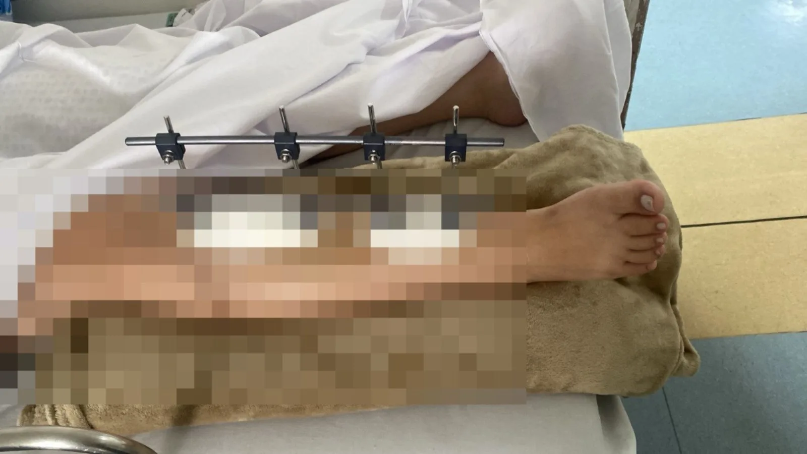 atropelamento-em-posto-de-combustiveis-deixa-vitima-internada-no-hugo-em-goiania