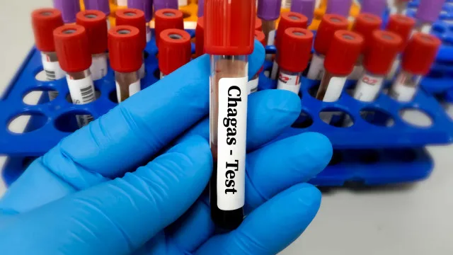 Projeto busca tratar doen&ccedil;a de Chagas perto da casa dos pacientes