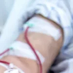 Homem contaminado por ácido durante hemodiálise morre no RJ após coma 1 Homem contaminado por ácido durante hemodiálise morre no RJ após coma