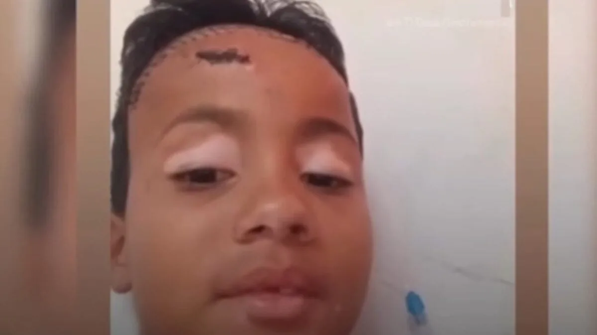 crianca-espancada-com-paulada-na-cabeca-em-caldas-novas-recebe-alta