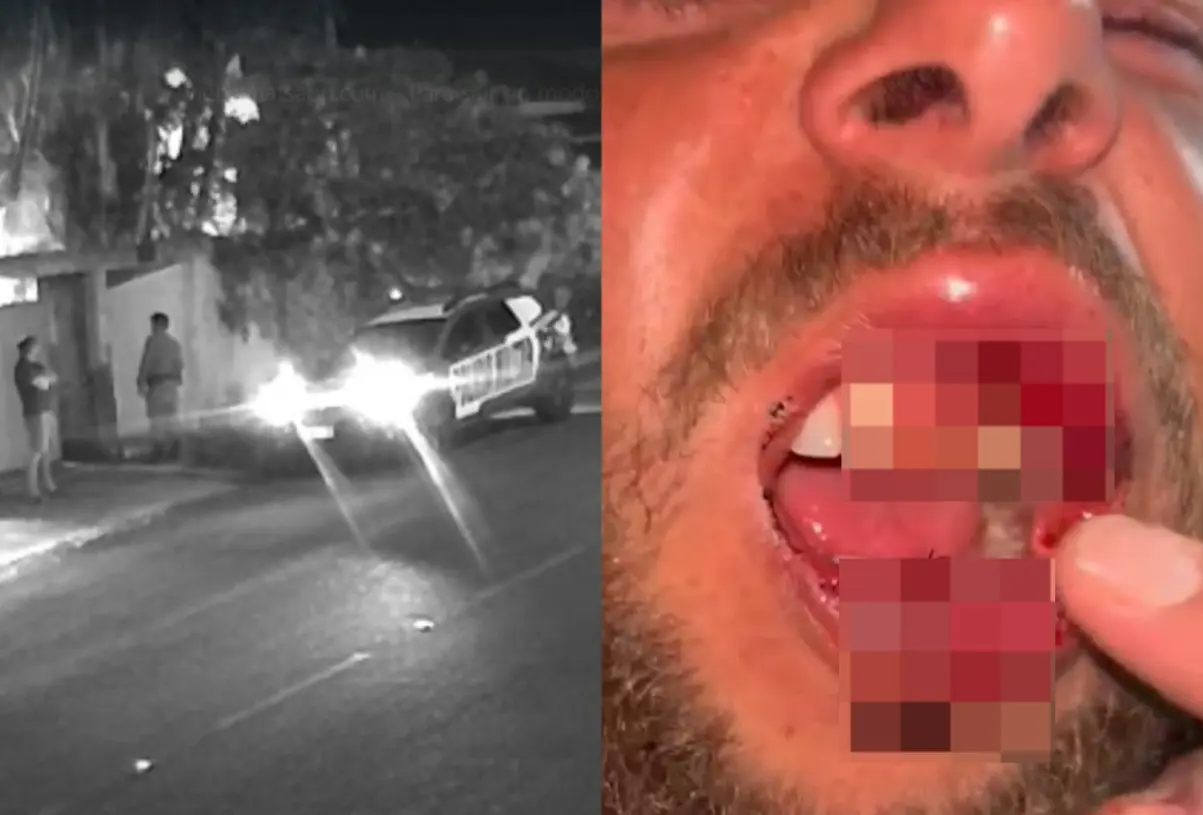 morador-de-goiandira-denuncia-que-foi-agredido-por-pms-apos-discussao-politica;-vitima-levou-6-pontos-e-teve-dente-quebrado