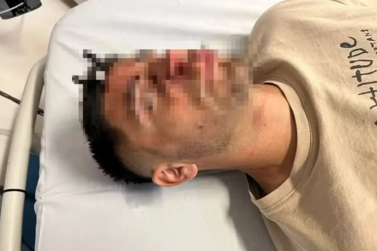 jogador-fica-com-chave-de-carro-cravada-na-testa-apos-briga-em-estadio