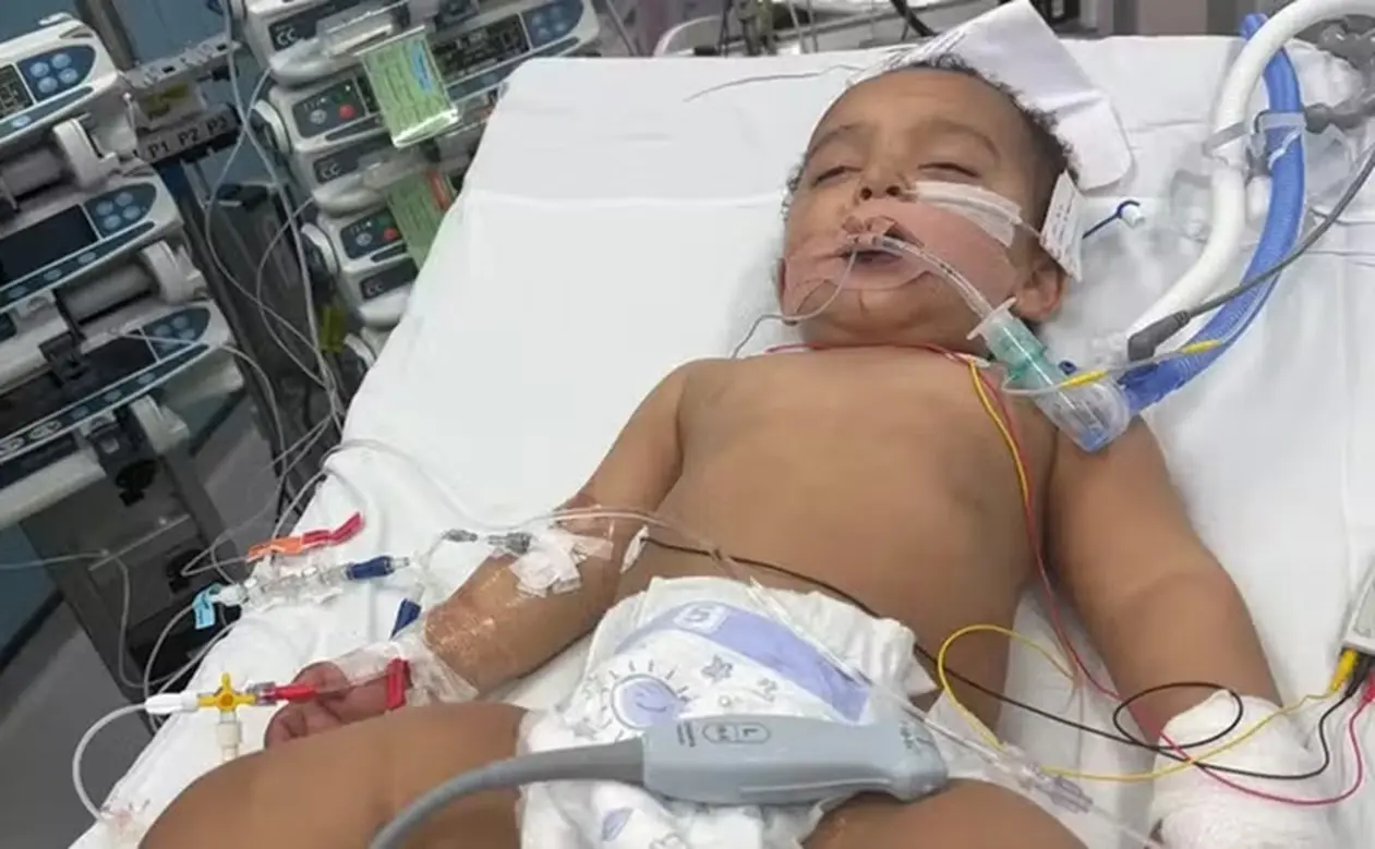 bebe-sofre-ataque-cardiaco-e-perde-parte-da-lingua-ao-confundir-mamadeira-com-soda-caustica