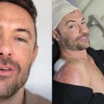 kayky-brito-sofre-novo-acidente-dois-anos-apos-atropelamento grave