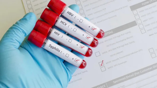 Gonorreia est&aacute; se tornando cada vez mais resistente a antibi&oacute;ticos, alerta a OMS