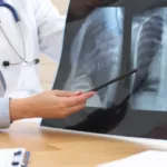 Estado de São Paulo vive boom de pneumonia e casos quase triplicam em três anos