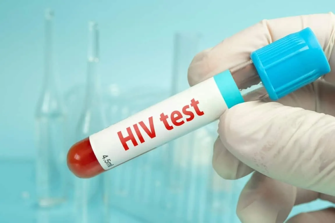 dia-mundial-do-hiv:-secretaria-de-saude-oferece-testagem-rapida-gratuita-em-dia-de-conscientizacao