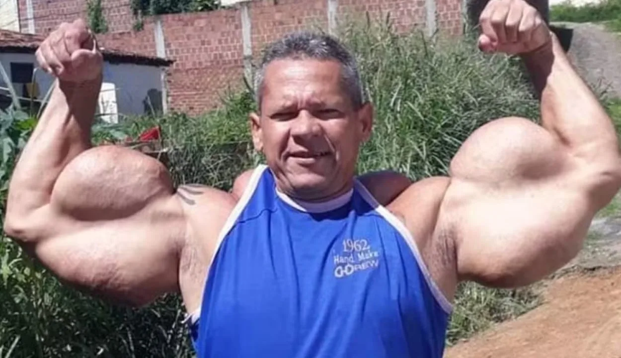 arlindo-de-souza,-o-‘popeye-brasileiro’,-morre-aos-55-anos-no-recife-por-complicacoes-renais-graves