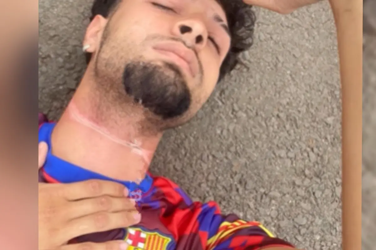 motociclista-fica-ferido-apos-se-enroscar-em-fio-de-internet-solto-em-rua-de-anapolis