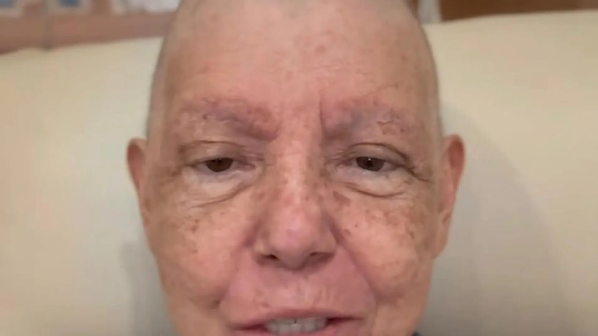 roseana-sarney-e-internada-com-pneumonia-durante-tratamento-contra-cancer