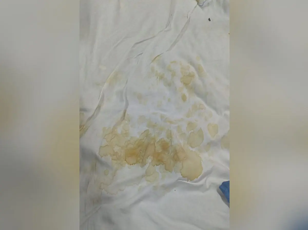 falta-de-lencois-obriga-pacientes-a-permanecerem-em-leitos-sujos-no-hugol,-em-goiania