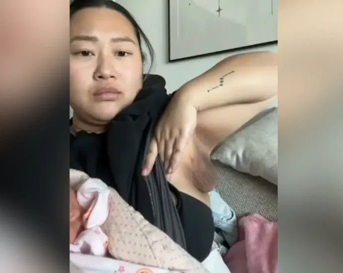 mulher-desenvolve-‘terceiro-seio’-apos-dar-a-luz:-entenda-o-que-e-a-polimastia