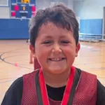 menino-fica-com-o-rosto-deformado-apos-participar-de-desafio-no-tiktok;-veja-foto