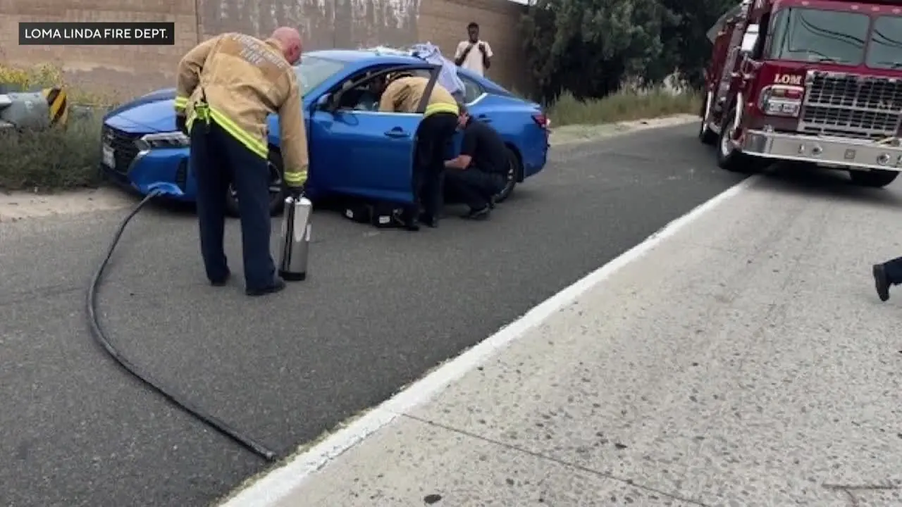 imagens-fortes:-jovem-sobrevive-apos-acidente-deixar-cabo-de-metal-cravado-na-barriga