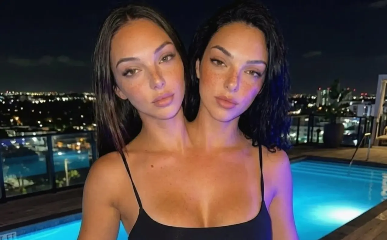 com-foto-de-biquini,-“gemeas-siamesas”-ultrapassam-331-mil-seguidores,-mas-verdade-vem-a-tona