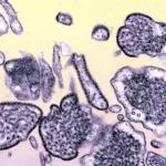 brasil-nao-tem-caso-de-nipah-confirmado,-esclarece-ministerio-da-saude