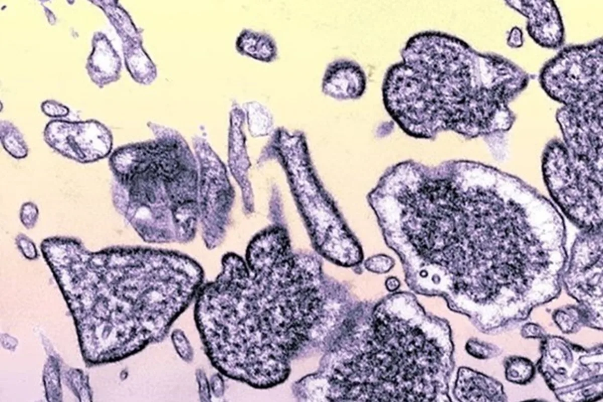 brasil-nao-tem-caso-de-nipah-confirmado,-esclarece-ministerio-da-saude