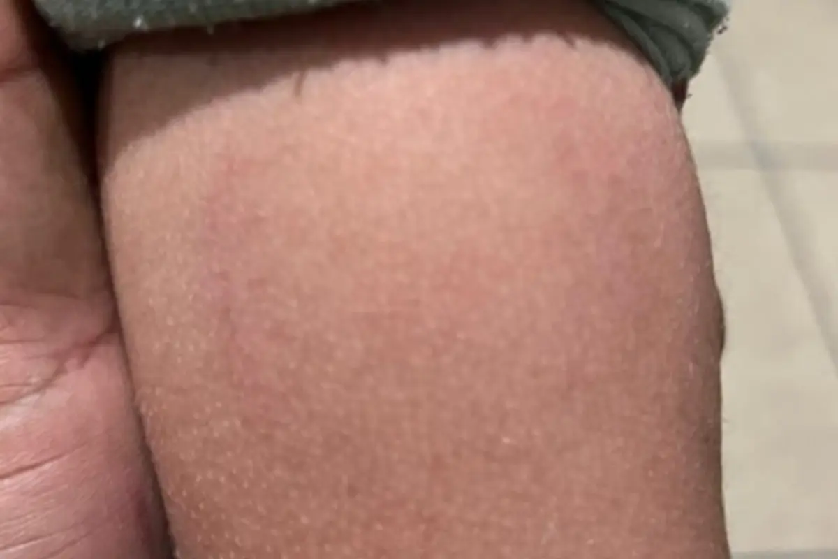 mae-denuncia-maus-tratos-apos-filho-de-3-anos-ser-mordido-por-diretora-de-bercario-em-goiania