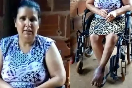 go:-mulher-contaminada-com-fungo-aguarda-ha-mais-de-400-dias-por-cirurgia-para-amputar-pe