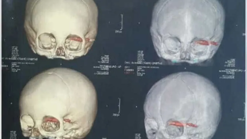 cientistas-acham-cranios-de-2.000-anos,-e-detalhe-nos-dentes-chama-atencao