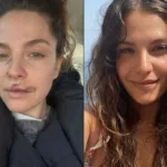 atriz-de-‘the-good-doctor’-revela-ter-sofrido-ataque-de-cachorro-e-mostra-rosto-ferido