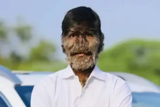 jovem-com-o-rosto-mais-peludo-do-mundo-celebra-‘emprego-dos-sonhos’;-veja-fotos