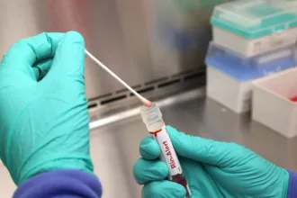 casos-de-mpox-mais-que-dobram-em-20-dias,-com-129-confirmacoes-no-brasil