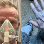 homem-acorda-com-o-corpo-azul,-corre-para-hospital-e-se-surpreende-com-diagnostico