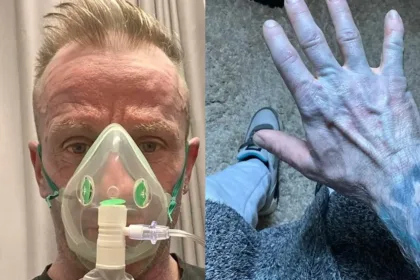 homem-acorda-com-o-corpo-azul,-corre-para-hospital-e-se-surpreende-com-diagnostico