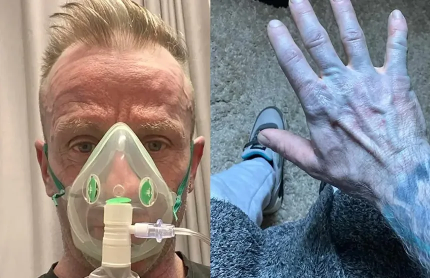 homem-acorda-com-o-corpo-azul,-corre-para-hospital-e-se-surpreende-com-diagnostico