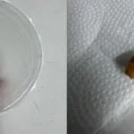 policia-investiga-se-crianca-de-um-ano-morreu-por-engolir-pedra-de-crack-em-goianesia