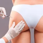 sociedade-brasileira-de-dermatologia-defende-suspensao-do-pmma-em-procedimentos-esteticos