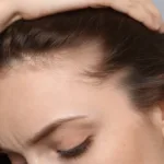 sofrendo-com-queda-de-cabelo?-icf-goias-busca-voluntarios-para-tratamento;-veja-como-participar