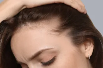 sofrendo-com-queda-de-cabelo?-icf-goias-busca-voluntarios-para-tratamento;-veja-como-participar