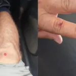 jovem-invade-casa-de-vizinho-e-parte-para-cima-de-policial-em-rio-verde