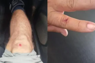 jovem-invade-casa-de-vizinho-e-parte-para-cima-de-policial-em-rio-verde