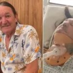 mulher-de-marquito,-internado-ha-um-mes,-diz-que-ele-fraturou-costela-e-duas-vertebras