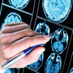 mais-de-50%-dos-diagnosticos-de-autismo-ocorrem-antes-dos-5-anos-de-idade