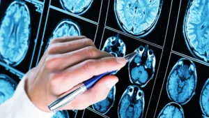 mais-de-50%-dos-diagnosticos-de-autismo-ocorrem-antes-dos-5-anos-de-idade