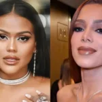 camila-loures-elimina-veia-da-testa;-anitta-ja-passou-pelo-procedimento-em-goiania;-veja-fotos