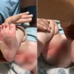 go:-bebe-fica-ferido-apos-ser-queimado-durante-banho-em-bercario