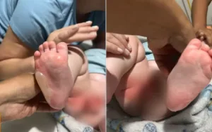 go:-bebe-fica-ferido-apos-ser-queimado-durante-banho-em-bercario