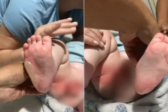go:-bebe-fica-ferido-apos-ser-queimado-durante-banho-em-bercario