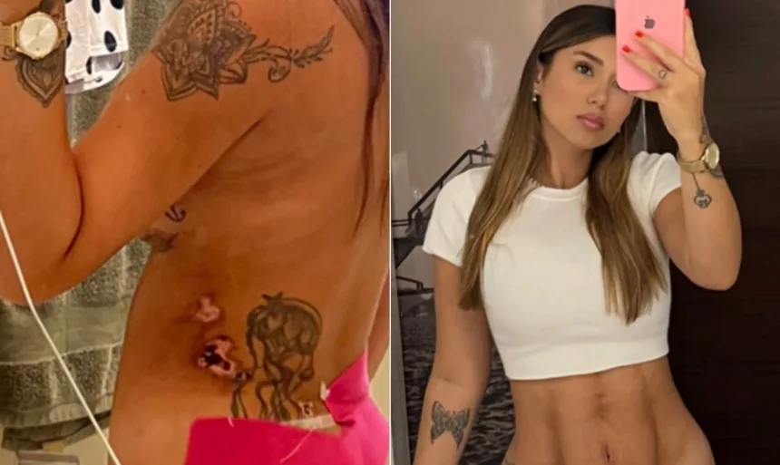 influenciadora-que-denunciou-‘clinica-das-estrelas’-nao-podera-amamentar-apos-necrose-nos-seios,-afirma-marido;-entenda-–-o-globo