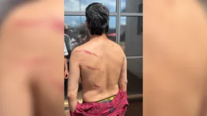 preso-por-desacato-a-pm,-vereador-do-pt-de-goiania-mostra-ferimentos-nas-costas