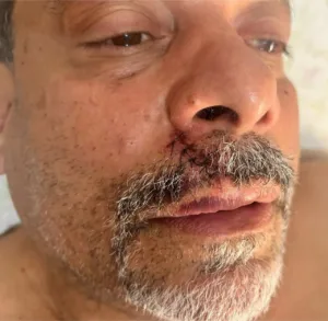 acusado-de-racismo,-ex-presidente-do-vila-fala-de-agressao,-gesto-e-afirma:-“denuncia-caluniosa”