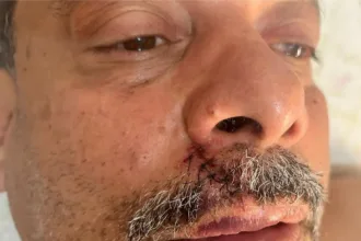 acusado-de-racismo,-ex-presidente-do-vila-fala-de-agressao,-gesto-e-afirma:-“denuncia-caluniosa”